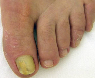 Anerer sprooch liesen